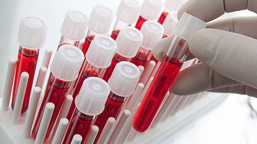 Hindistan’da yeni bir kan grubu keşfedildi.