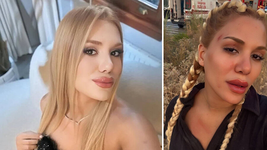 Survivor'un Almeda'sı kaza geçirdi