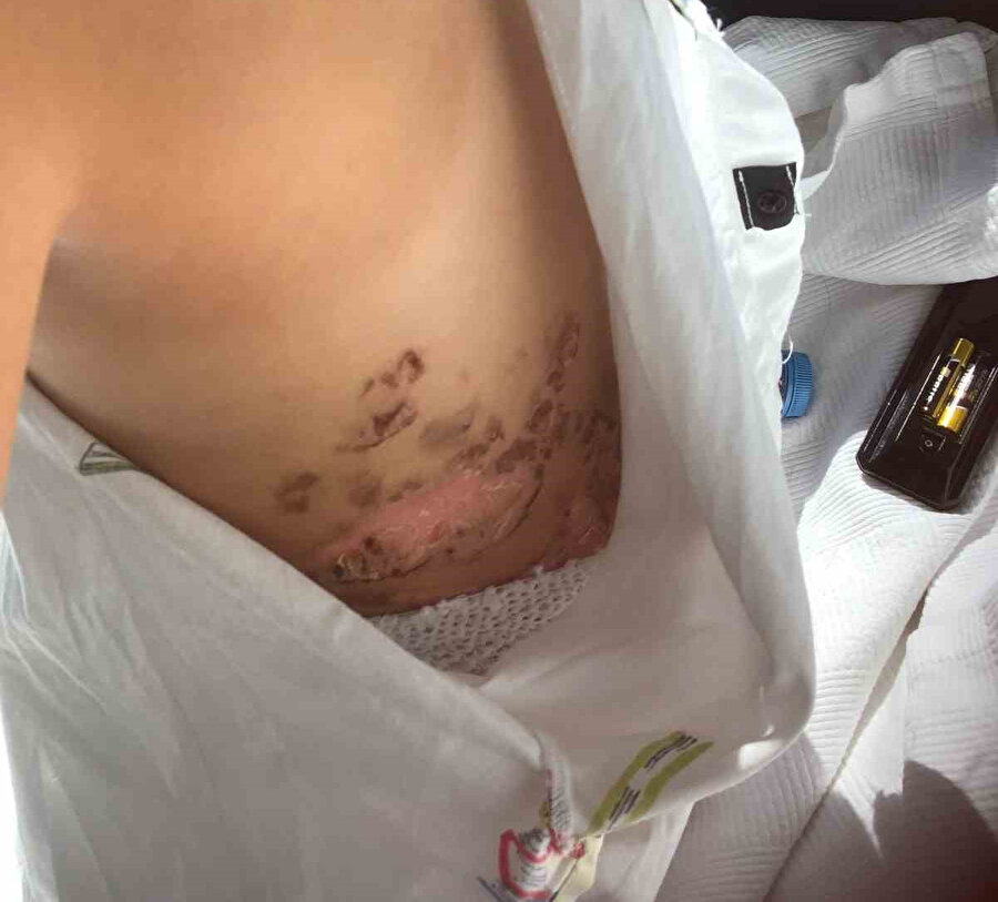 Nevşehir'de düğünde azotlu dehşet