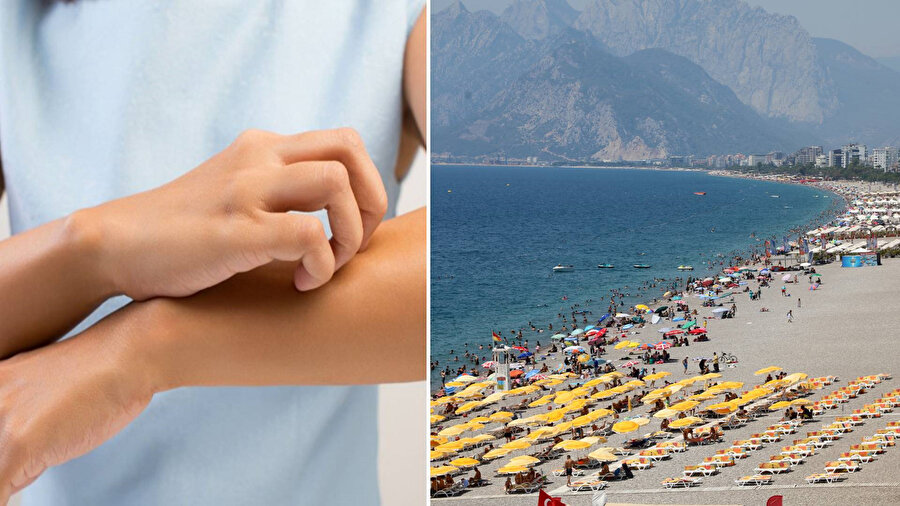 Deniz suyu sıcaklığı rekor seviyelere ulaştı: Kaşıntı ve yanma şikayetlerinde patlama yaşanıyor