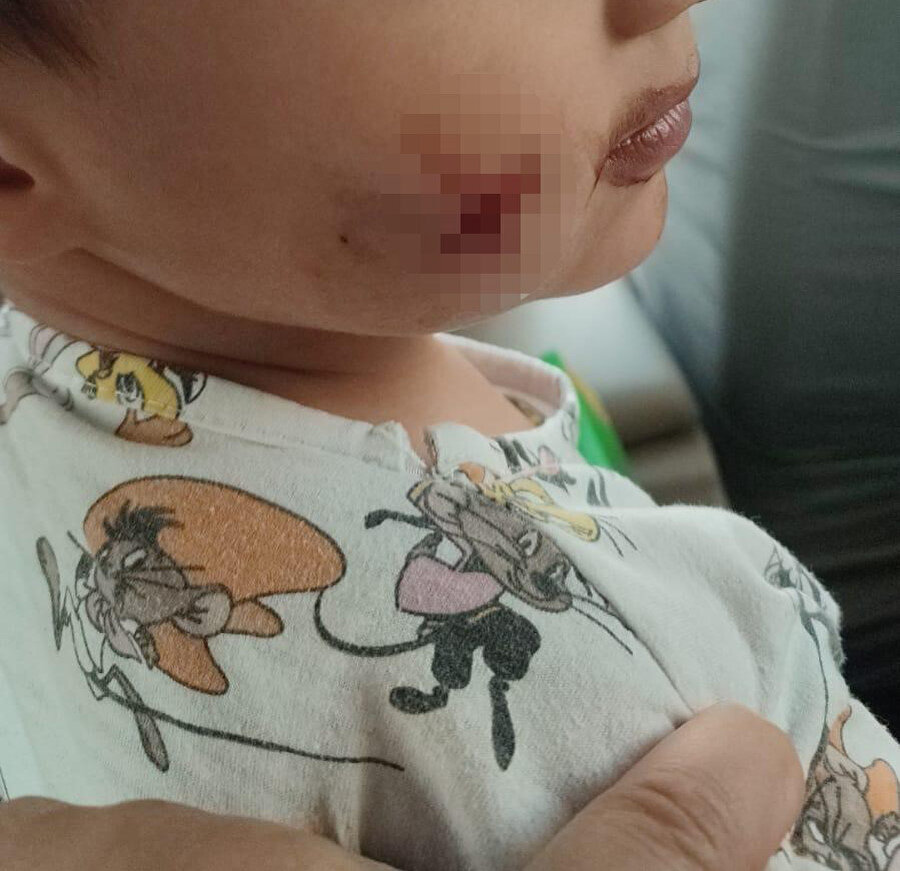 Lağım faresi uyuyan çocuğu ısırdı