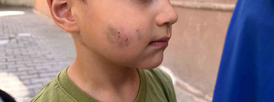 Lağım faresi uyuyan çocuğu ısırdı