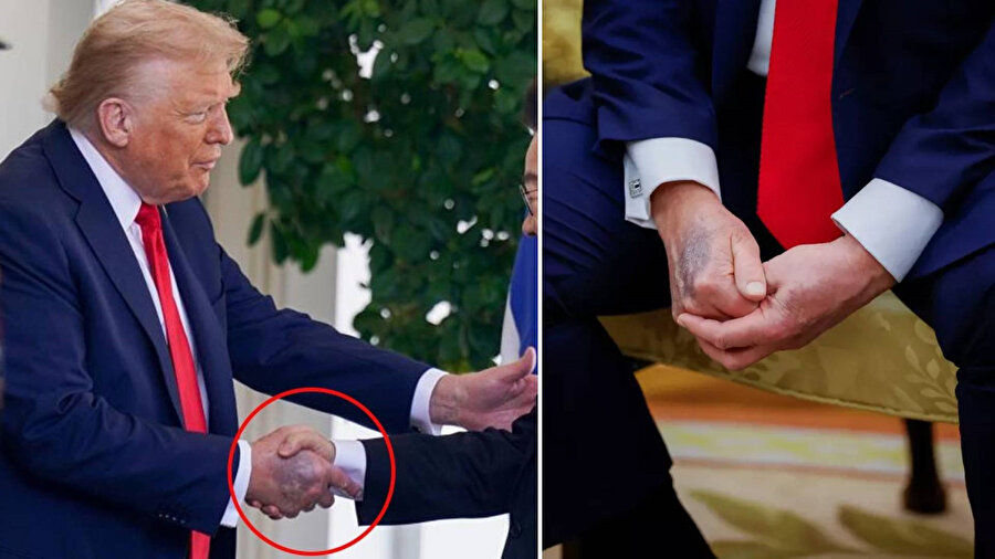 Trump’ın elindeki morluk