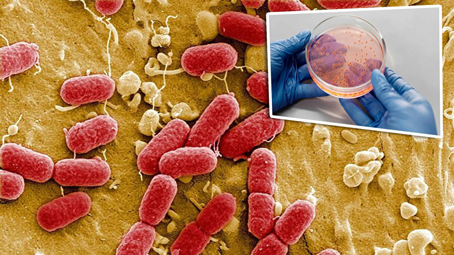 Et yiyen bakteri can alıyor