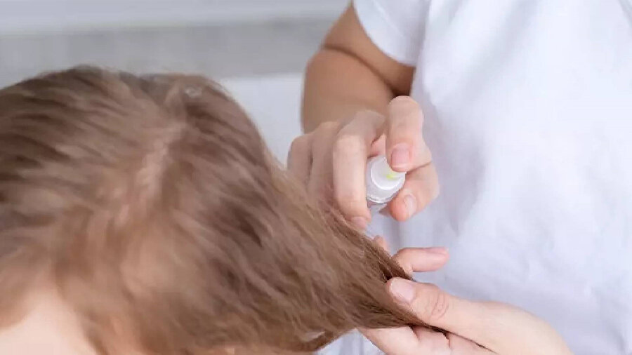 İlkokul çağındaki çocuklarda saç sağlığı