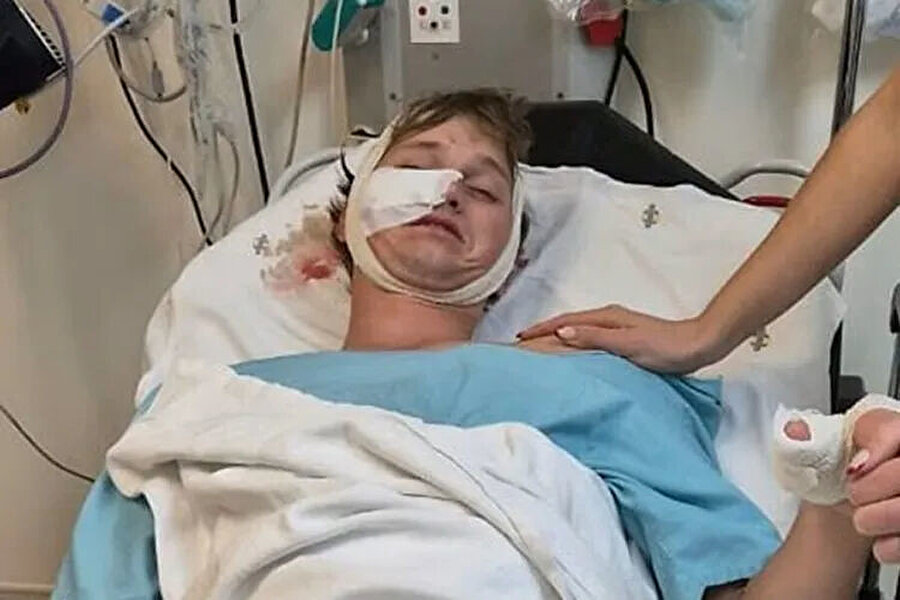 Sırtlanların saldırısına uğradı