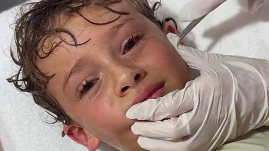 Yapılan detaylı inceleme sonucunda doktorlar, çocuğun kulağından bir yengeç çıkardı.