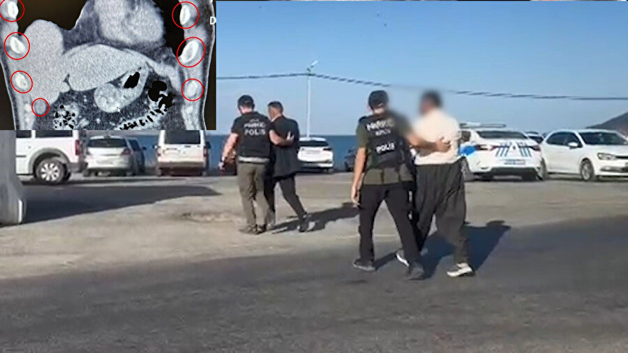 ​Akılalmaz kaçakçılık: Midelerinden yüzlerce uyuşturucu çıktı