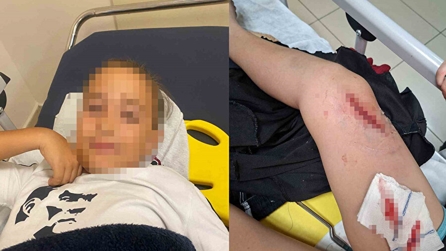 Okul bahçesinde bayrak direği öğrencilerin üzerine devrildi: 1 çocuk yaralandı