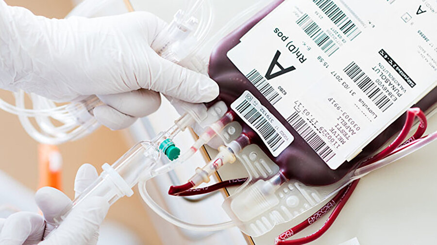 Uzmanlar kan nakli yoluyla iyatrojenik serebral amiloid anjiyopati (ICAA) adlı ölümcül beyin hastalığının bulaşabileceği konusunda endişelerini dile getirdi.