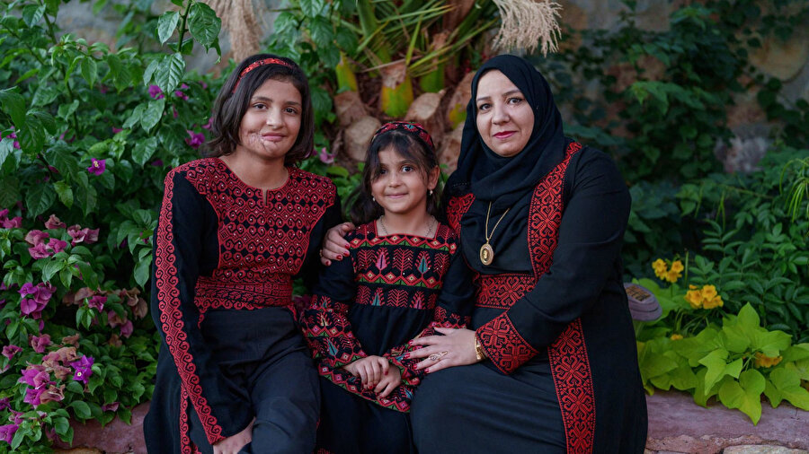 ​İsrail saldırısında yüzü parçalanan 13 yaşındaki Gazze’li Mazyouna Damoo, ABD’de geçirdiği ameliyatlar sonrası yeniden gülümsemeye başladı.