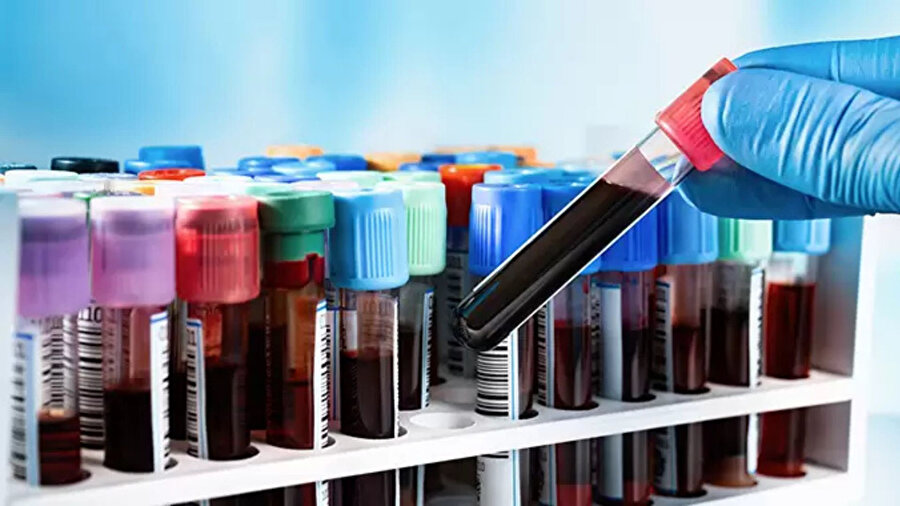 Yeni geliştirilen Galleri kan testi, 50’den fazla kanser türünü erken evrede tespit edebiliyor