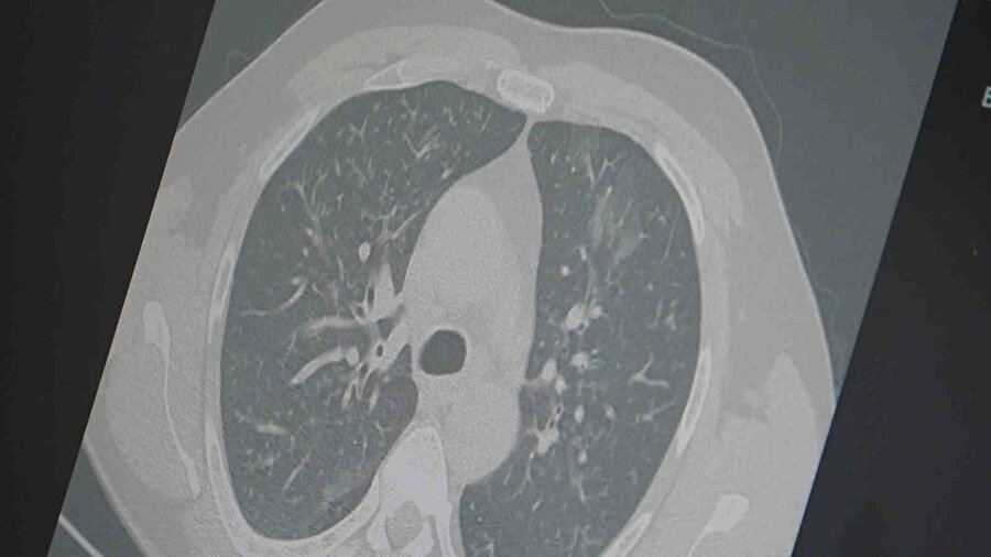 Yeni salgına dikkat