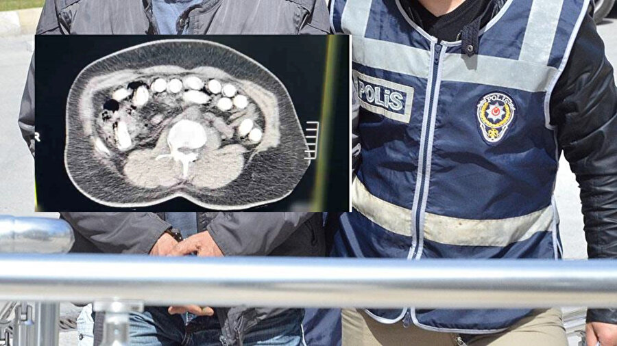 Hastaneye sevk edilen kuryenin oyunu röntgende ortaya çıktı