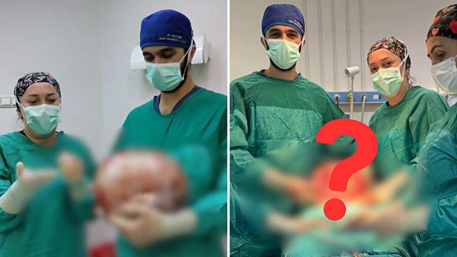 Karnı 2 ayda hamile gibi büyüdü, içinden çıkan kitle boyutuyla şoka uğrattı!