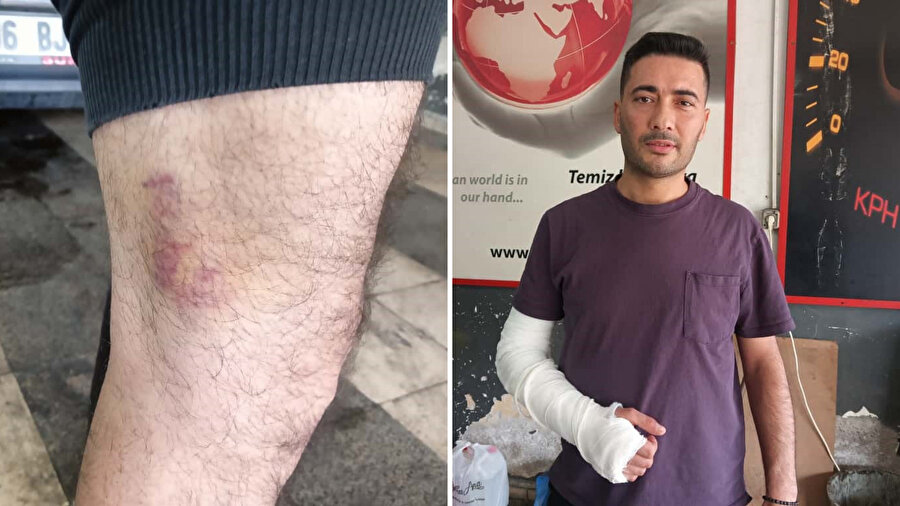 Küçük çocuğunun önünde kolu kırıldı