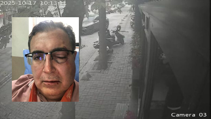 Ünlü iş insanına sokak ortasında feci saldırı