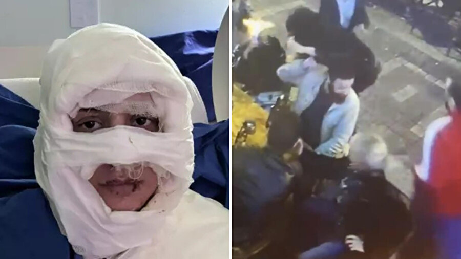 ​Kadıköy’de bir kadın başka bir kadını yaktı: Olay sonrası görüntüsü görenleri dehşete düşürdü