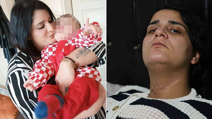 Eşi boğazını kesti engelli kaldı