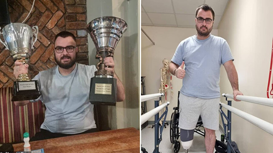 Aaron Haley, forklift kazası sonrası bacağını kestirdi ve milyon sterlinlik tazminat talebinde bulundu.