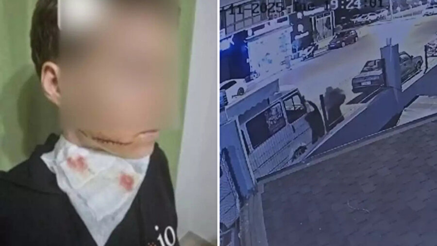 ​Alanya’da sokak ortasında dehşet: Yolda yürüyen kadının yüzünü kesti