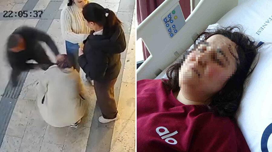 ​Gümüşhane’de boşanma sürecindeki kadına bıçaklı saldırı