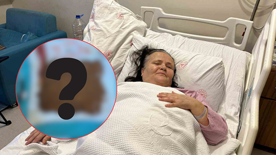 Görüntü şoke etti | Yapay zekayla saydılar: Safra kesesinden ameliyat olan kadının binlerce taş çıkarıldı