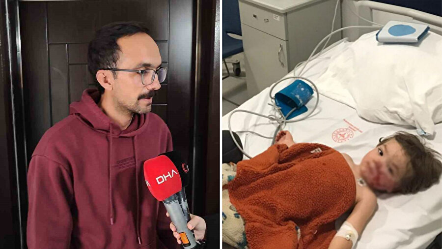 ​Ankara’da çocuklarına pitbull saldıran acılı baba isyan etti: &quot;Bu kız hakkında 12 tane şikayet varmış...&quot;