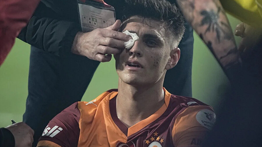 Derbi bitti Galatasaray'dan paylaşım geldi: Yüzündeki yara, alnımızın akıdır