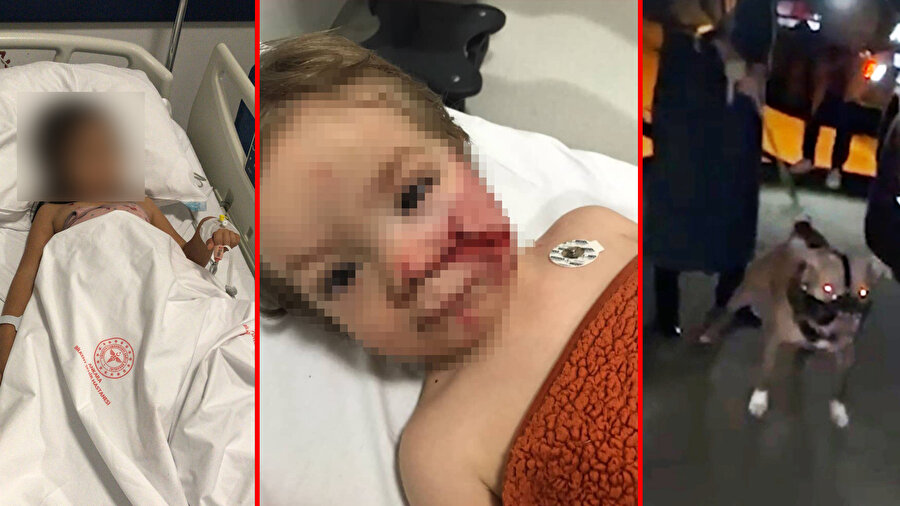 Ankara'da pitbull terörü iki küçük çocuğu hastanelik etmişti: 12 şikâyete rağmen durdurulmamış! Aile adalet istiyor