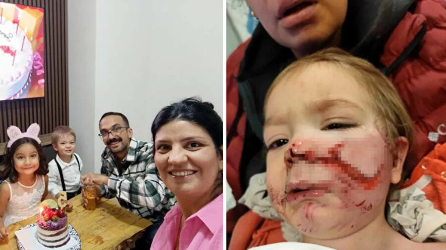 ​Pitbull saldırısında yaralanan küçük çocuk ile ilgili sevindiren gelişme