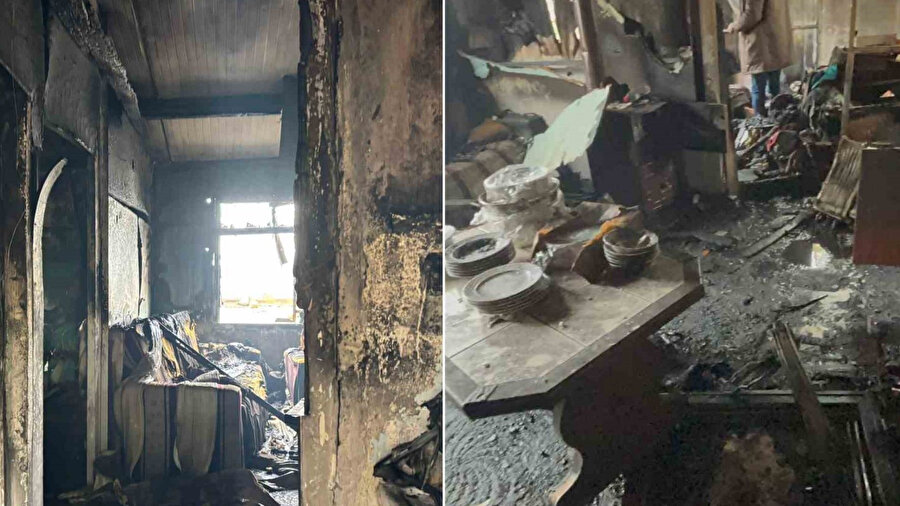 2 ay önce bacakları ampute edilmiş