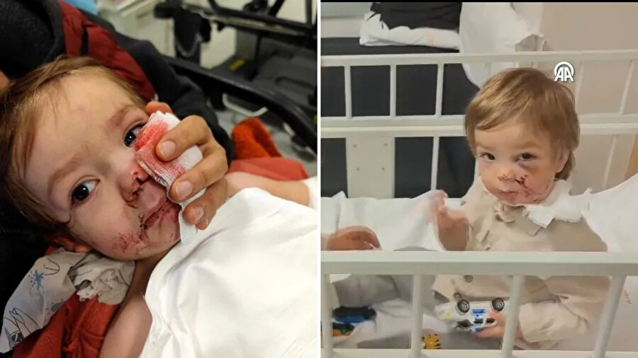 İfadesi ortaya çıktı | Ankara’daki pitbull saldırısında köpeğin sahibinden şaşırtan savunma