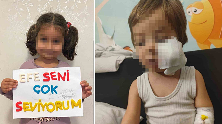 Pitbull saldırısına uğrayan Efe bebek taburcu oldu