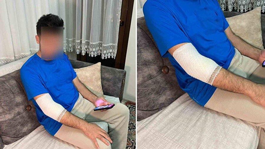  Başakşehir’de sitenin güvenlik görevlisine sahipli köpek saldırdı. 