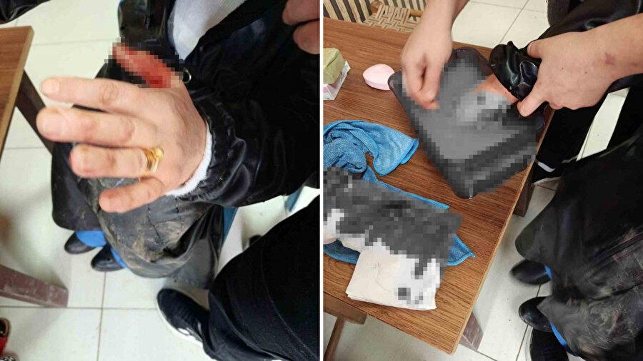 Diyarbakır’da köpek saldırısına uğrayan 2 kişi yaralandı