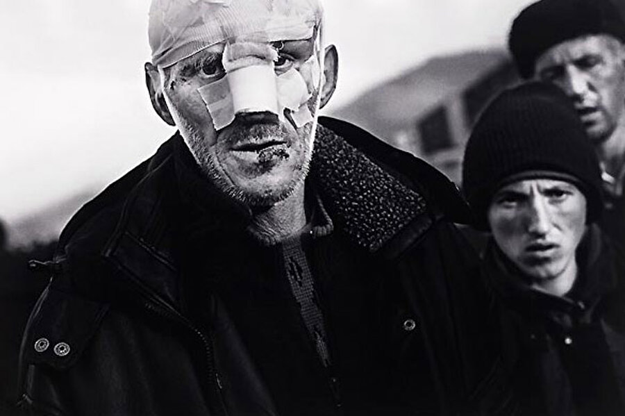 1999 Claus Bjorn Larsen
Yaralı Arnavut Danimarka'da mültecilerin yaşadığı sokaklarda bandajlar içinde yürüyor.