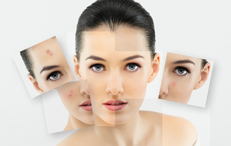 Cildinizi sevin!
Tıpkı sizi anlıyormuş gibi onu koruyun, özen gösterin. Elinize ilk geçen mendille değil, sizin cilt tipinize göre olan ürünlerle ve nazikçe temizleyin.