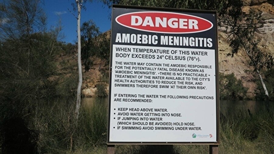 Son olarak da su birikintisinin sıcaklığı eğer 24 dereceyi geçerse içindeki organizmalar bir tür menenjit hastalığına sebep oluyor. Kurtulma şansı sadece %3!! Bunları bilmeniz Avustralya'ya gitmeye karar verdiğinizde sizin için yararlı olacak ufak detaylar... 

                                    
                                    
                                    
                                    
                                    
                                    
                                    
                                    
                                    
                                    
                                    
                                    
                                    
                                
                                
                                
                                
                                
                                
                                
                                
                                
                                
                                
                                
                                