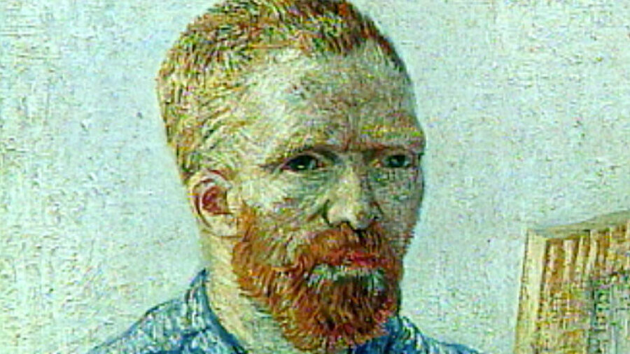 Vincent van Gogh (1853 - 1890)
Dünyanın en tanınmış ressamlarından olan Van Gogh birçok hastalığa sahipti, şizofreni, bipolar bozukluk, frengi bunlardan birkaçı…
Van Gogh'un özellikle son dönem eserlerinde açıkça görülen sarı renk düşkünlüğünün de tıbbi bir bozukluktan kaynaklandığını ileri sürenler olmuştur.
1888'de ressam Paul Gauguin ile arkadaşlığının bozulması üzerine sol kulağının bir kısmını kesmiş, giderek kötüleşen ruhsal hastalığı sonucunda kendini göğsünden vurarak intihar etmişti.