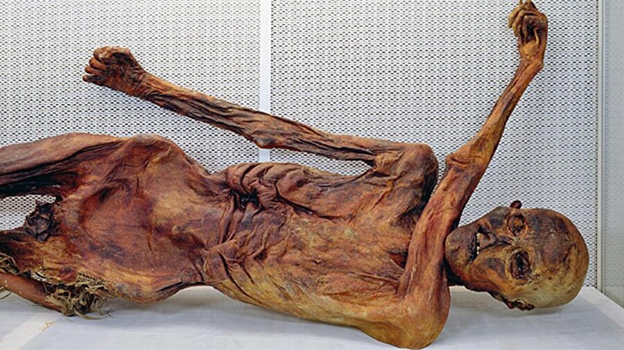 PEK ÇOK SAĞLIK SORUNU VARDI

                                    Ötzi'nin günümüzde çoğu insanın muzdarip olduğu pek çok sağlık sorunu vardı. Dişlerinde tartar olan Ötzi kene ısırığının yol açtığı lyme (borelyoz) hastasıydı ve kenelerle amansız bir savaş içindeydi. Laktoz hassasiyeti vardı ve kamp ateşinin başında çok fazla zaman geçirdiği için akciğerleri dumandan sigara tiryakilerinin ciğerlerini andırıyordu. Ötzi bir de kan dolaşımı bozukluğu çekiyordu.

                                