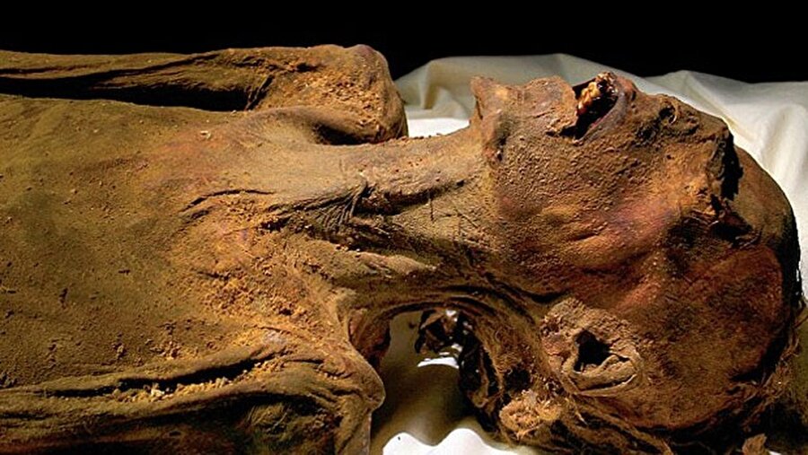 İç organları hala duran mumya

                                    Çığlık atan bu mumyanın iç organları hala duruyor. Aslında mumyalanma sürecinde görülmeyen bir durum bu. Teoriler farklı farklı; ama hiçbiri tam olarak durumu açıklamaya yetmiyor. Bazı kaynaklara göre bu mumya III. Ramses'in oğullarından Prens Pentewere'ye ait.


                                