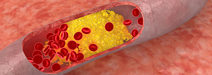 Kolesterolü dengeler

                                    
                                    
                                    
                                    İncirde bulunan lifler, kolesterolü destekleyip denge sağlar.
                                
                                
                                
                                