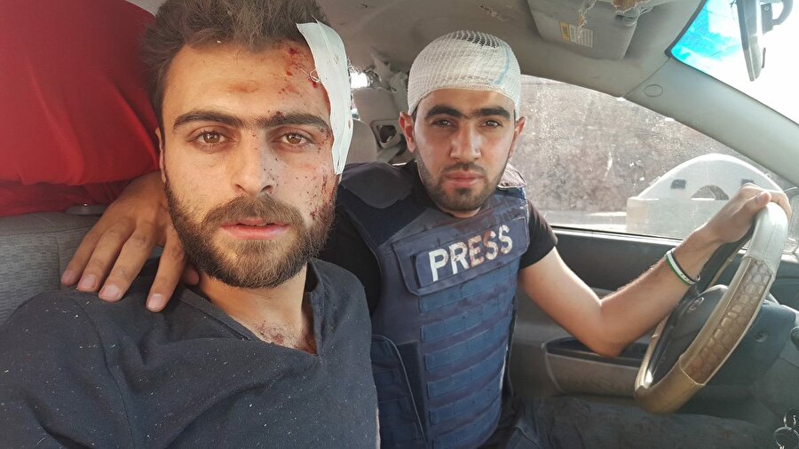 Hâdi Alabdallah, birden çok kez ölümden döndü ve birden çok çalışma arkadaşını kaybetti.

                                    
                                    En son Nisan 2016'da Halep'te evinin önünde yerleştirilen ve kendisini hedef alan bombanın infilak etmesi soncunda ağır yaralandı. O gün yanında bulunan kameramanı ve en yakın arkadaşı Halid El İsa hayatını kaybetti. Daha önce de benzer bir şekilde de başka bir yakın arkadaşını kaybeden gazeteci, bunu aylar sonra geçirdiği birden çok ameliyatın ardından tekrar yazmaya başladığında anlattı.
                                
                                