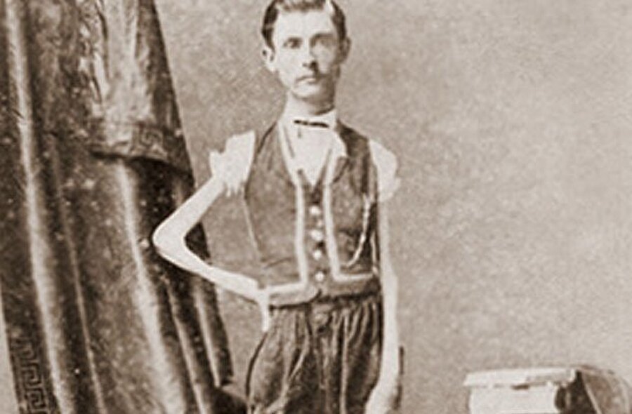Isaac W. Sprague

                                    
                                    12 yaşından itibaren önlenemez kilo kaybı yaşadı ve 'yaşayan iskelet' olarak tanınıyordu.
                                
                                