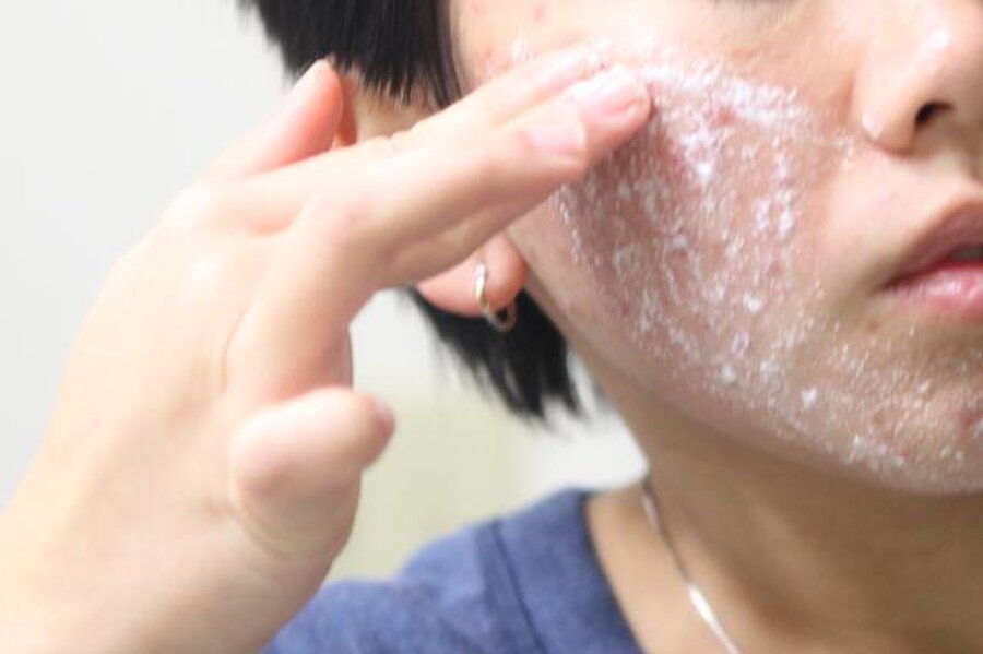 Peelign yapabilirsiniz
Yüzünüze haftada bir kez de olsa peeling yapın. Bunun için satılan makinelerden temin edebileceğiniz gibi peeling maskeleri de kullanabilirsiniz. 

