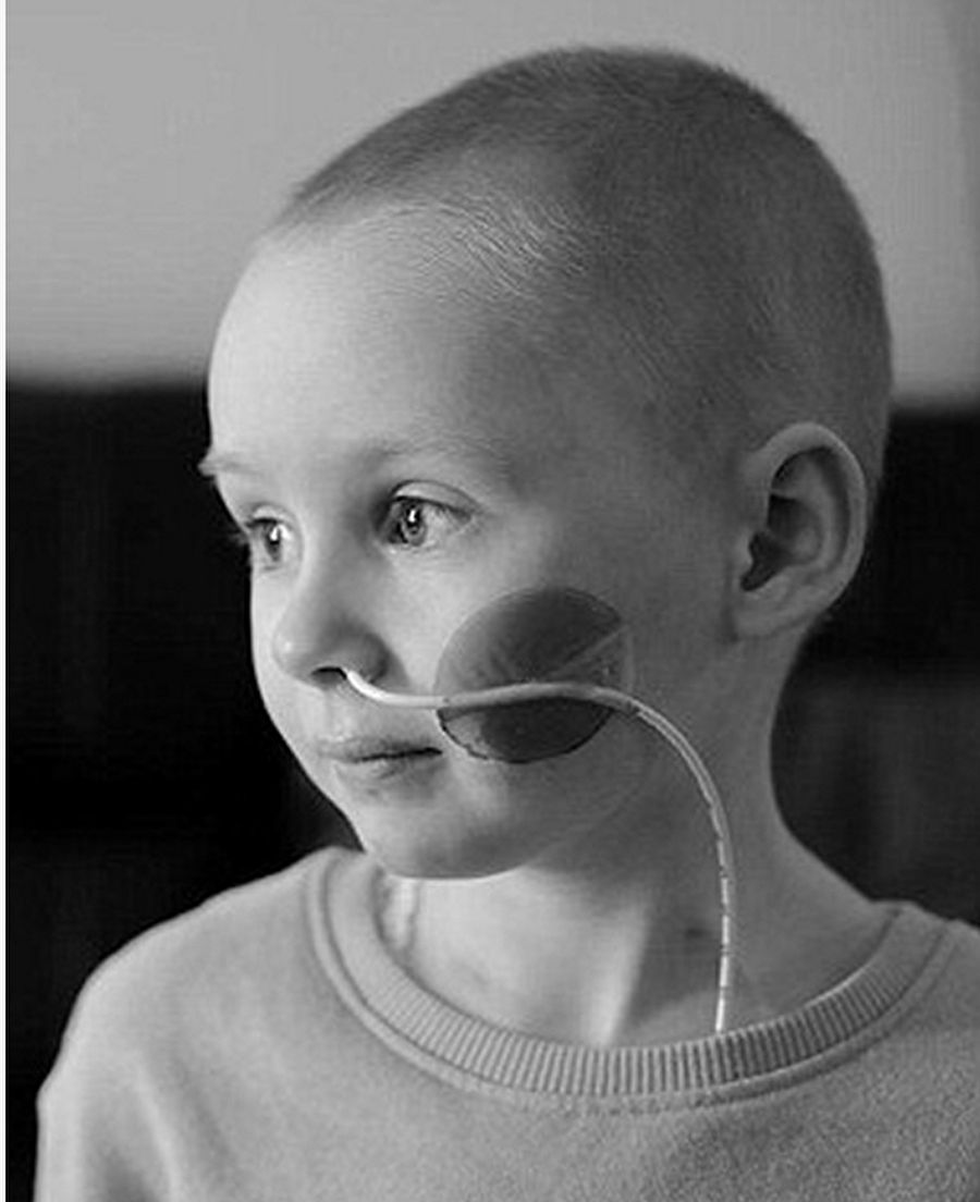 Nöroblastom nedir?

                                    
                                    Dört yaşındaki Jessica'nın hayatını alan nöroblastom kanseri, çocukluk çağı kanserlerindendir. Daha çok bebeklik çağında görülmektedir. 
Bu hastalık teşhis edildiğinde çoğunlukla başka organlara yayılmış olur. 

                                
                                
