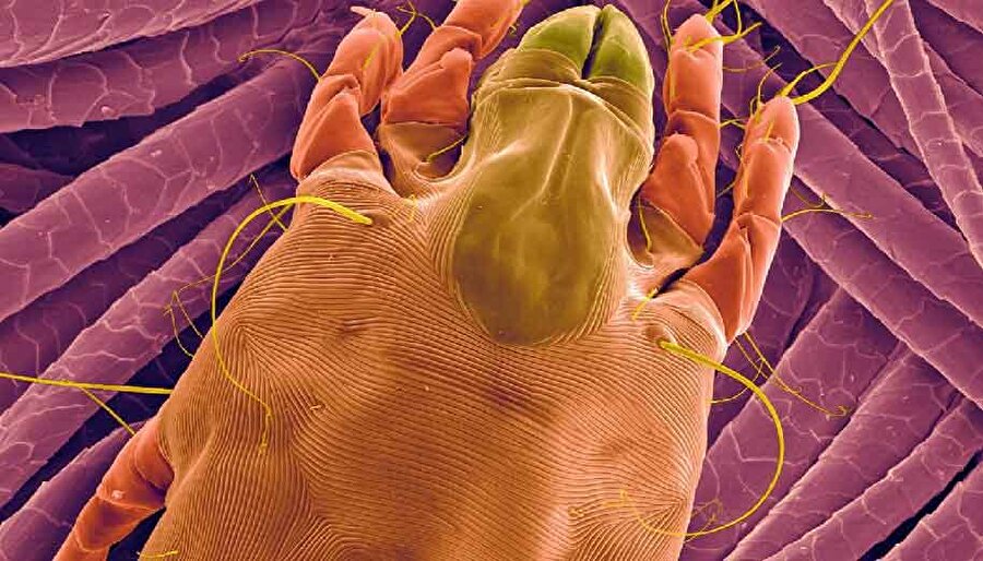 Бактерии на грязных руках фото под микроскопом