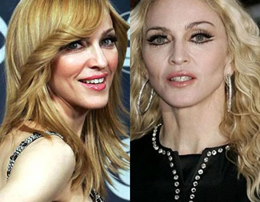 Madonna

                                    58 yaşındaki Madonna'nın zaman içinde yüzü tamamen değişti.
                                
