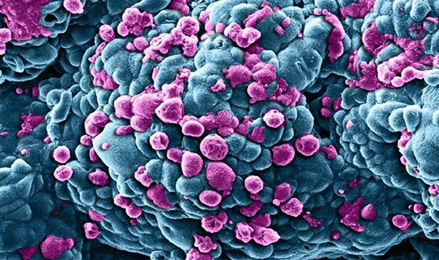 Nobel Odullu Doktor Kansere Neden Olan Gizli Sirri Aciga Cikardi